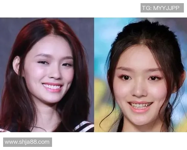 整容改变命运的足球球星揭秘他们的颜值背后故事 整容改变命运的足球球星揭秘他们的颜值背后故事